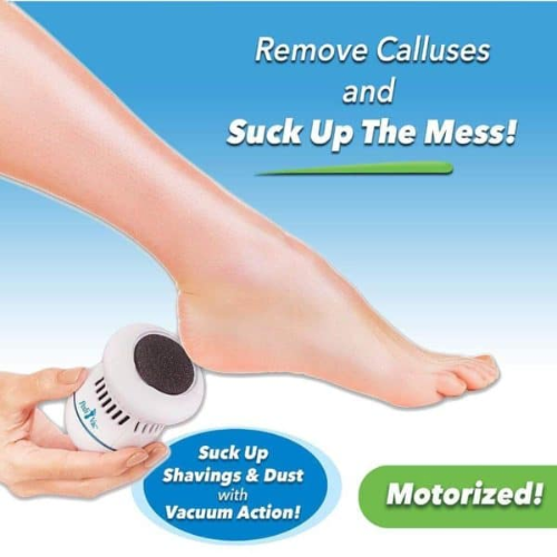 Electric Pedivac - remove your callus easily